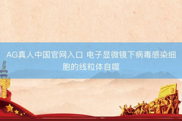 AG真人中国官网入口 电子显微镜下病毒感染细胞的线粒体自噬